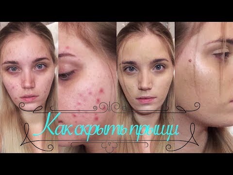 КАК ЗАМАСКИРОВАТЬ ПРЫЩИ | КАК БЫСТРО СКРЫТЬ ПРЫЩИ - YouTube