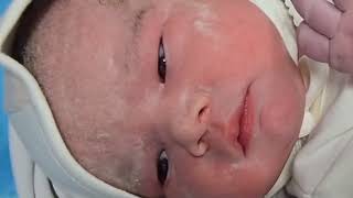 Newborn Baby’s First Moments After Birth 👶 | Heartwarming Baby Video 2025 💖