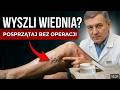 Wyszły żyły i niebieskie siatki? Plan pozbycia się krok po kroku