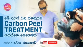 මේ දවස් වල ජනප්‍රියම Carbon Peel Treatment කරන්නෙ මෙහෙමයි