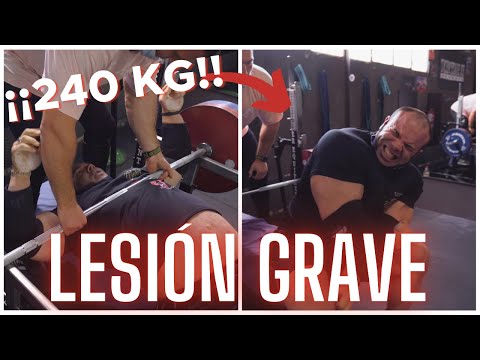 Me LESIONO GRAVEMENTE con *240 KG PRESS  BANCA* (¿ME OPERAN Y QUE PASA?)