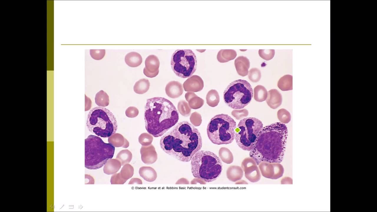HLS Pathology - CML - YouTube