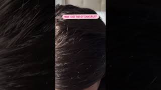 How I get rid of dandruff using a scalp massage brush screenshot 5