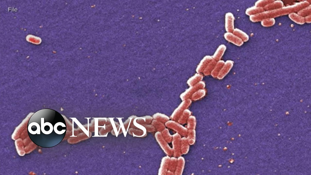 Wendy's serves burgers without lettuce amid E. coli outbreak | ABCNL