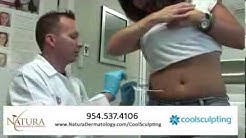 CoolSculpting Certified Practice | Fort Lauderale | Coconut Creek 