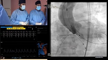 Align for the future with Myval THV series - From randomised trials to everyday clinical practice
