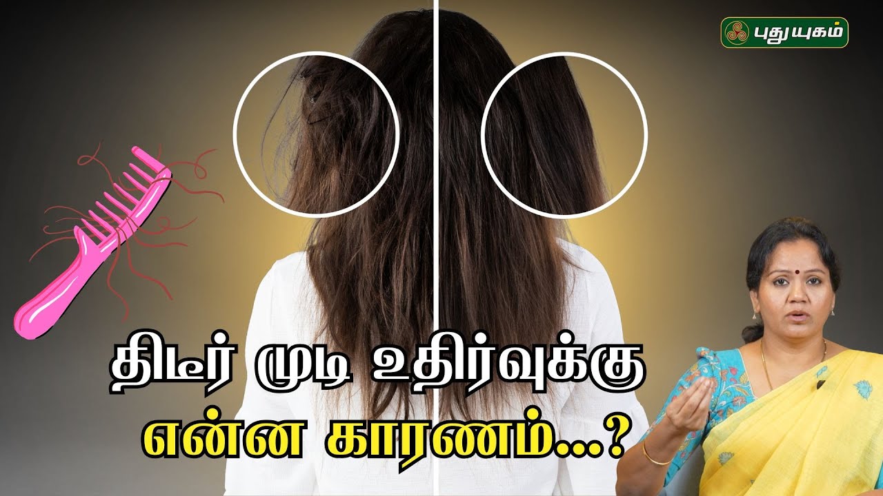 திடீர் முடி உதிர்வுக்கு என்ன காரணம்...? | Dr.Jayaroopa | Tamil Health Tips and Remedies | 02/02/2026