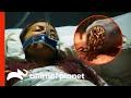 Tick Bite Infects Woman With Rare Parasites Monsters Inside Me Tick Bite Infects Woman With Rare Parasites Monsters Inside Me