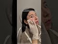 Rejuran Healer at DM Plastic Surgery #skincare
