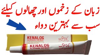 Kenalog in orabase ointment review | mouth infection Soultion |