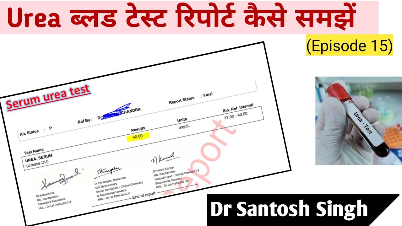 How To Read Blood Urea Test Report High Urea Kidney Dr Santosh How To Read Blood Urea Test Report High Urea Kidney Dr Santosh