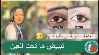 #الهالات_السوداء#free_beauty #جمالك_ببلاش  تحت العين اسبابها و طرق علاجها #fatma_assi