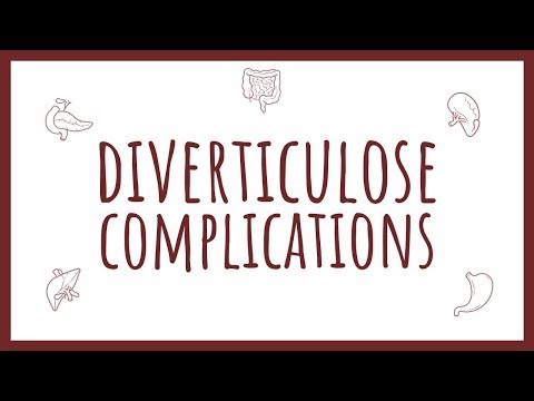 Vidéo: Chirurgie De La Diverticulite: Procédure, Récupération, Risques Et Plus