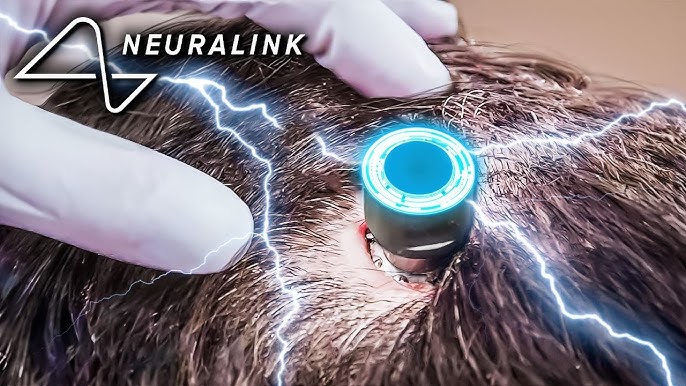 Elon Musk's Neuralink Begins Human Trials! - YouTube
