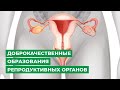 Доброкачественные новообразования женских половых органов. Фиброма, миома, полипы.