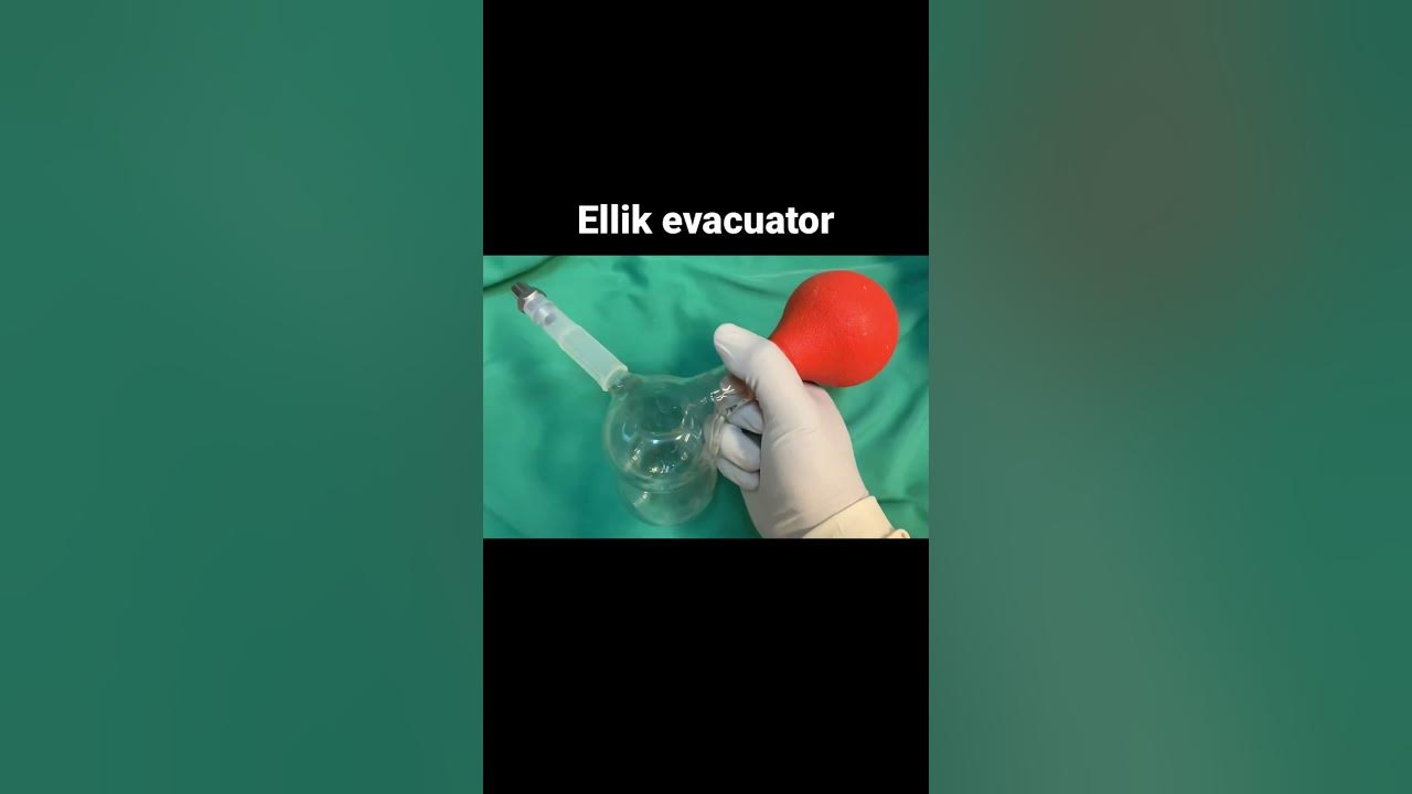 Ellik evacuator untuk mengambil sisa jaringan TURP #prostatecancer #bph #urologi #ellik #fypシ #fyp