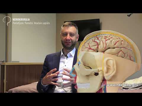 Video: Pirmās smadzeņu audzēja pazīmes
