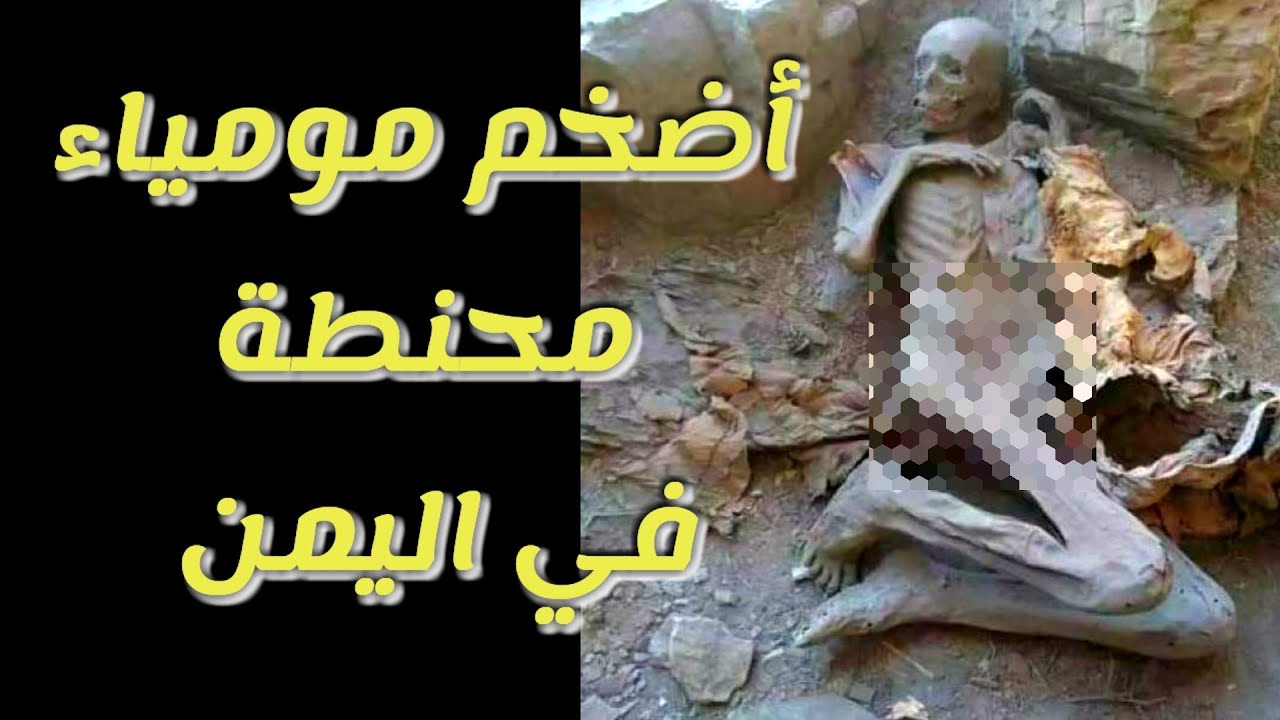 العبث بأضخم مومياء يمنية محنطة في محافظة إب| اليمن