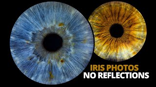 Professional eye photography tutorial | Iris photos with no reflections!