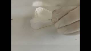 kesling separator : demo how to prepare and placement inbetween teeth