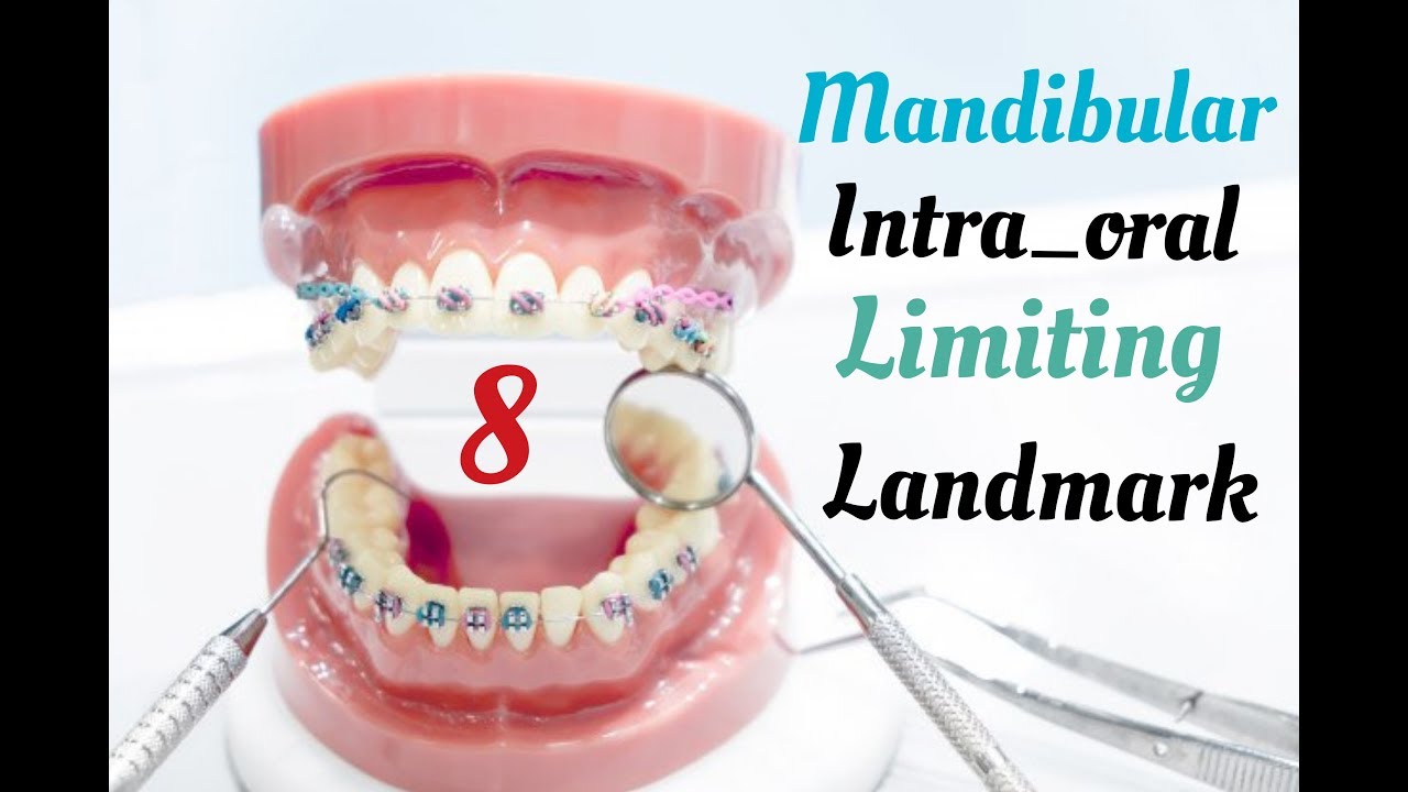 Prosthodontic_complete denture_lecture 2_mandibular limiting landmark 2 التركيبات المتحركة_المحاضرة