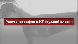 Рентгенография и КТ грудной клетки(Лекцию читает Кэти А. Спэлдинг — профессор радиологии Техасского A&M Университета, США., 2013-12-06T08:52:23.000Z)