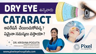 Is cataract surgery safe for dry eyes | కంటిశుక్లం |Dry eye| Dr krishna Poojita | Pixel eye hospital