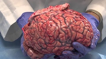 Dissecting Brains - professor Demonstrates dissecting Brain