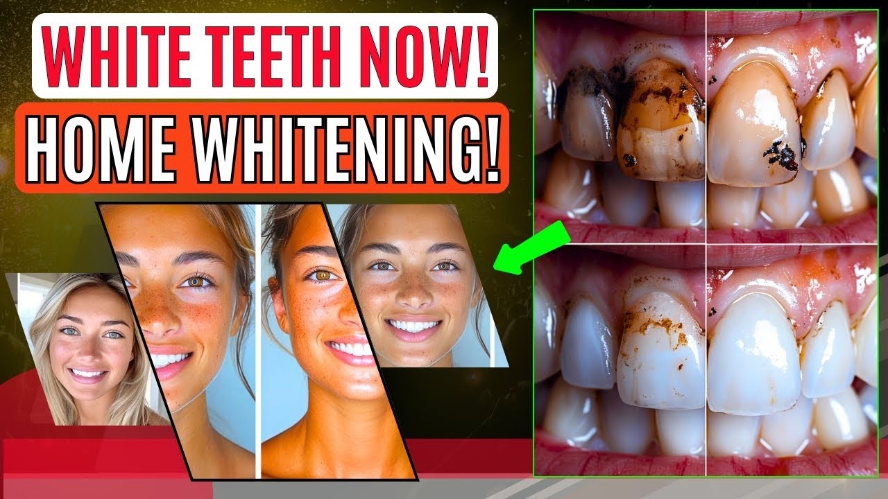 Fast Teeth Whitening Hacks You Can Do at Home! Yellow Teeth to White ...