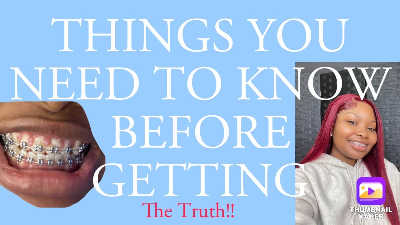Things You Need To Know Before Getting Braces - YouTube