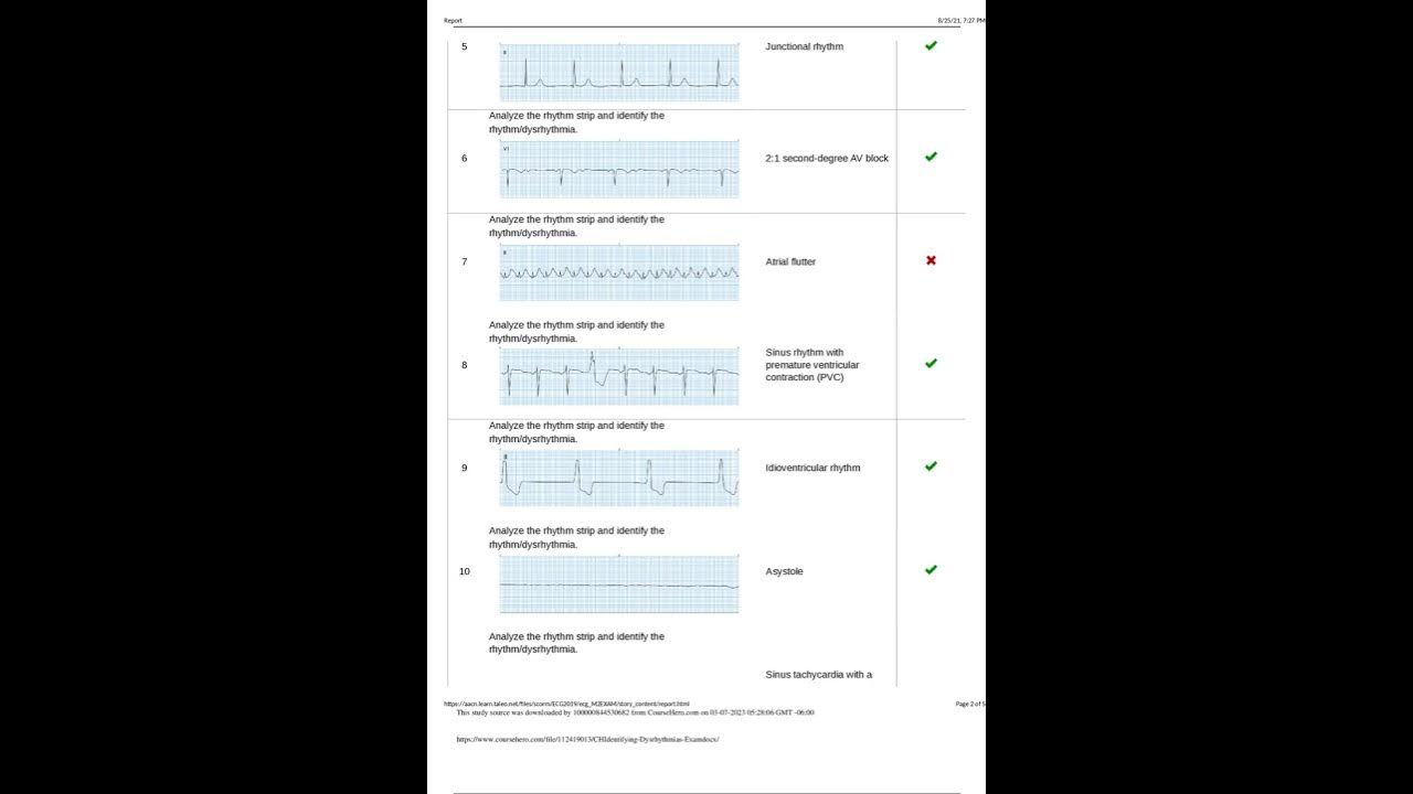 Relias Dysrhythmia Basic CH Identifying Dysrhythmias Exam Questions and