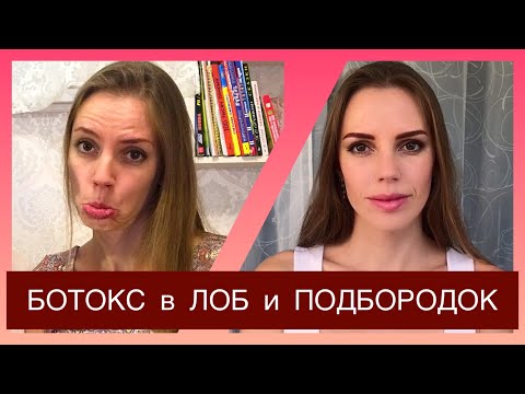 Видео: Ботокс для подбородка: что ожидать, стоимость, фотографии и многое другое