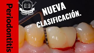 NUEVA CLASIFICACIÓN PERIODONTAL  CÓMO SE CLASIFICA LA PERIODONTITIS? [Actualización periodoncia]