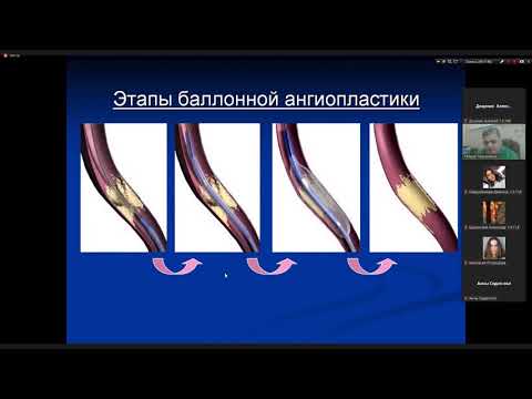 Видео: Как да организираме правилно изложбен щанд