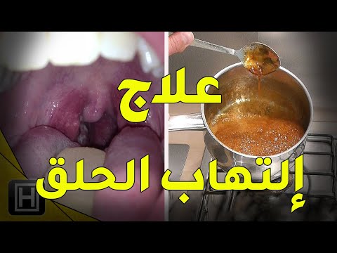 فيديو: كيف يتكاثر ulmus thomasii؟