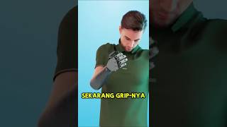 😮 Pria Ini Membuat Tangan Prostetiknya Sendiri di Rumah!