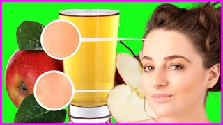 Apple Cider Vinegar Health Benefits For Skin | Apple Cider Vinegar For Acne by StayHealthy 193 views 4 years ago 2 minutes, 57 seconds