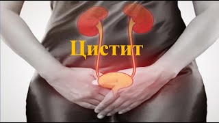 видео: ЦИСТИТ - ҚУЫҚТЫҢ ҚАБЫНУ АУРУЫ картинка: ЦИСТИТ - ҚУЫҚТЫҢ ҚАБЫНУ АУРУЫ