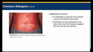 EMT- Chapter 21 Lecture - Allergy and Anaphylaxis