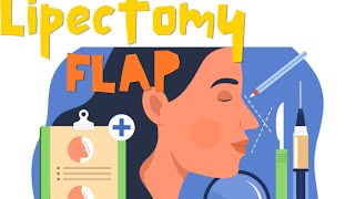 Lipectomy | Rhytidectomy | Blepharoplasty | Mid face flap | Island flap