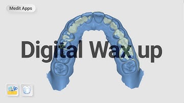 Designing temporary with digital wax up.