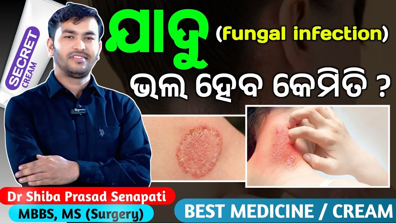 ଯାଦୁ ଭଲ ହେବ କେମିତି