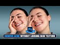 How to Remove Acne without Loosing Skin Texture - Smooth Skin Step by Step New Method #photoshop