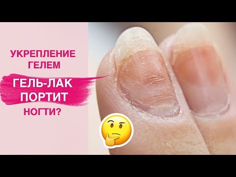 Спасаем ногти | УКРЕПЛЕНИЕ натуральных ногтей гелем