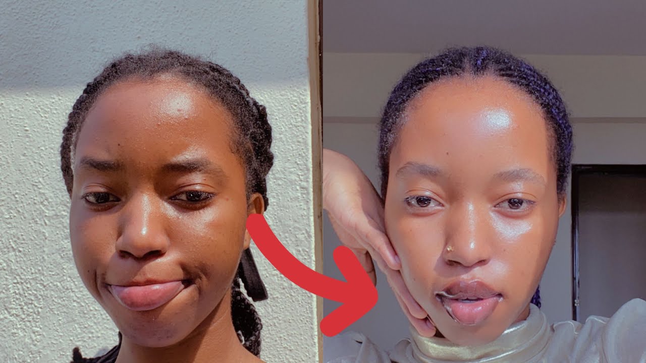 How I completely cleared my skin in two weeks. * simple easy everyday ...