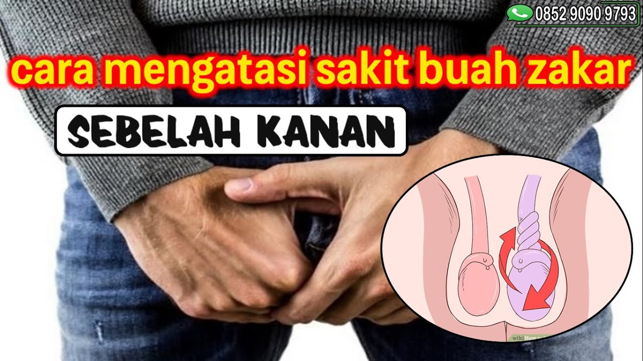 Cara Mengobati Zakar Besar Sebelah Cara Mengatasi Sakit Buah Zakar Sebelah Kanan – Edukasi.Lif.co.id