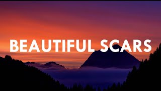 Beautiful Scars - Moira Dela Torre and Maximillian (Lyrics) [acoustic] | Your Music Corner