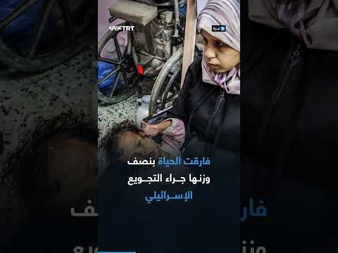 التجويع بدلاً من القصف: معاناة وصراع من أجل الحياة