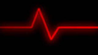 Heart Monitor on After Effects.