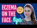 Eczema on the face: 11 tips from a dermatologist| Dr Dray
